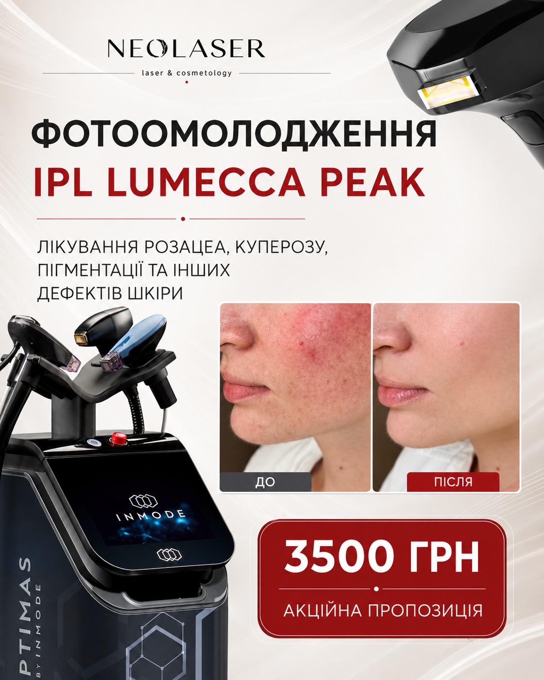 Спеціальна пропозиція NeoLaser 1